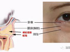 眼袋该怎么办？(长眼袋怎么办？)