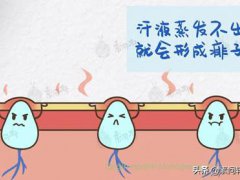 宝宝长痱子怎么回事(宝宝长痱子怎么办？)