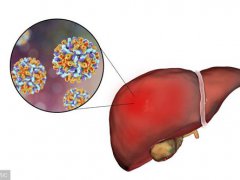 大三阳如何治(患有乙肝大三阳该怎么办？)