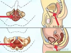 锻炼pc肌？(怎么锻炼PC肌？)