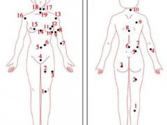 全身痣相(男女全身痣相图解测命运)